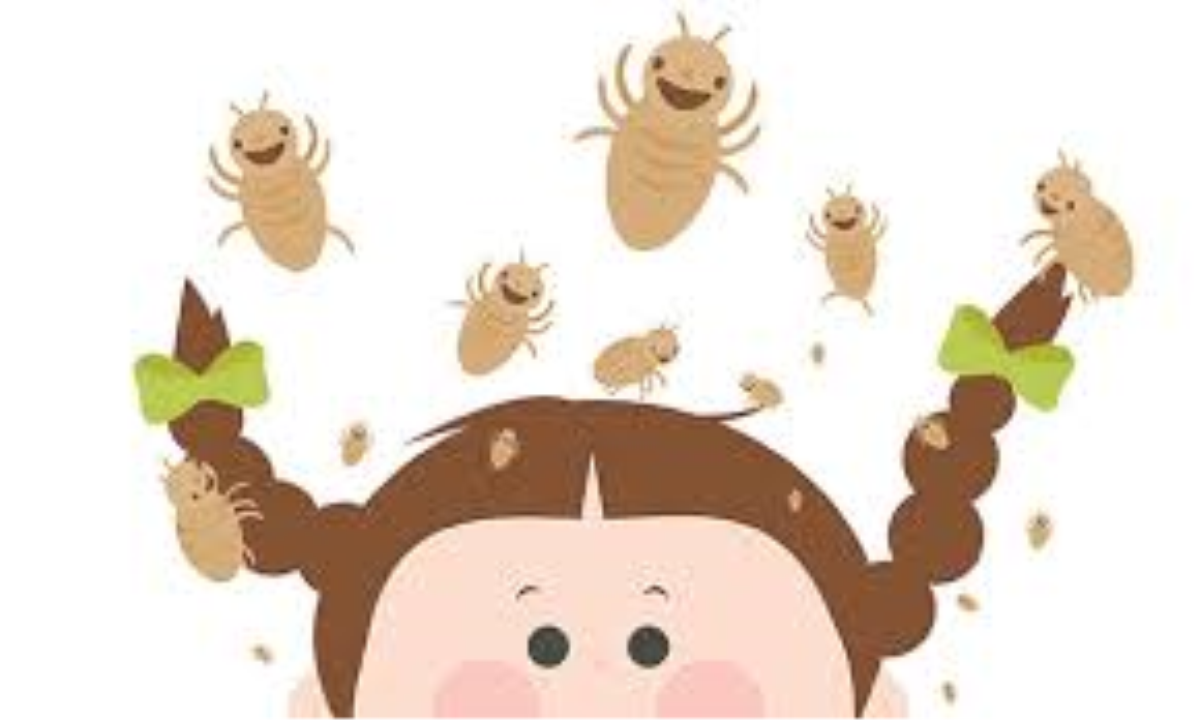 Image result for Head Lice cartoon